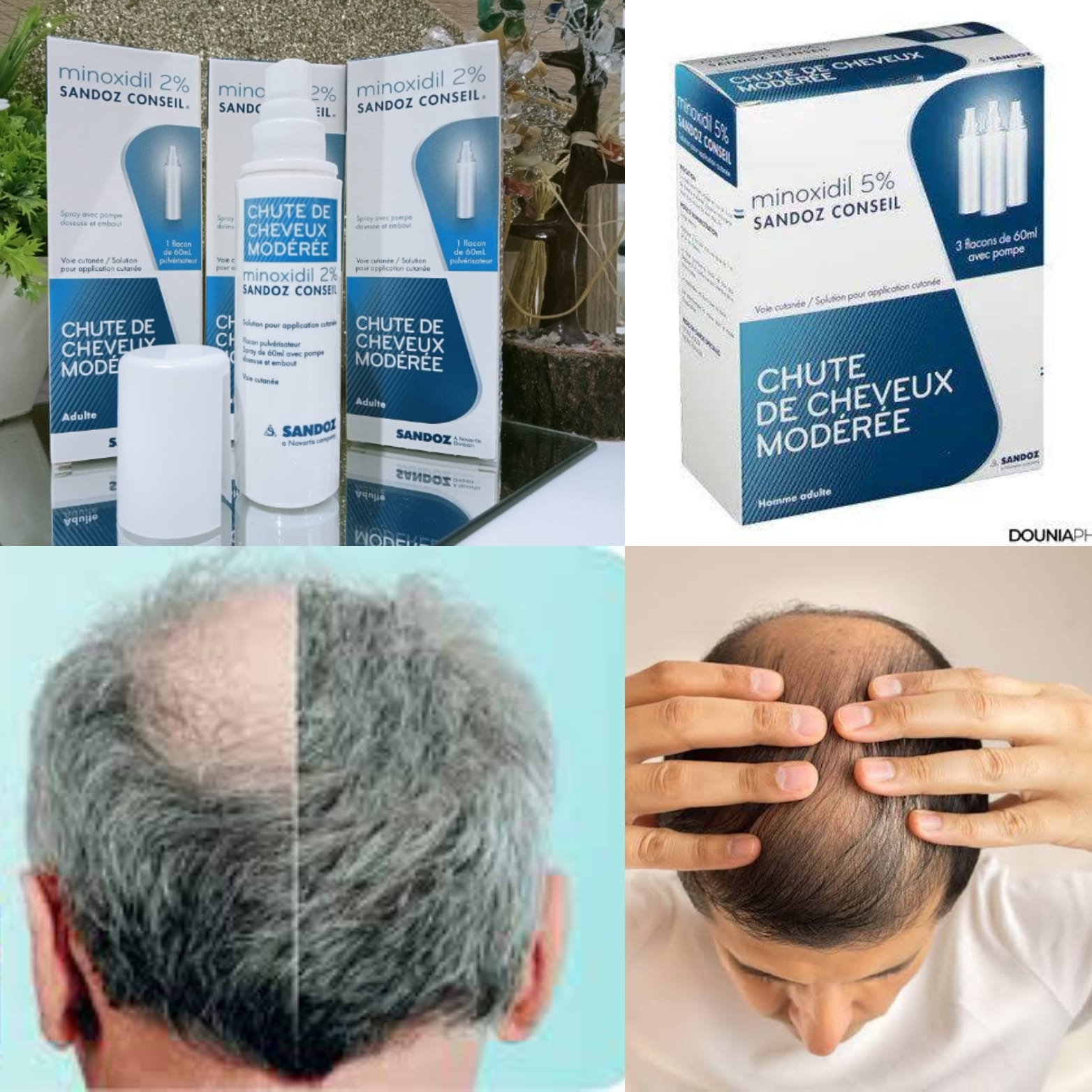 Minoxidil Sandoz 5%