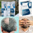Minoxidil Sandoz 5%